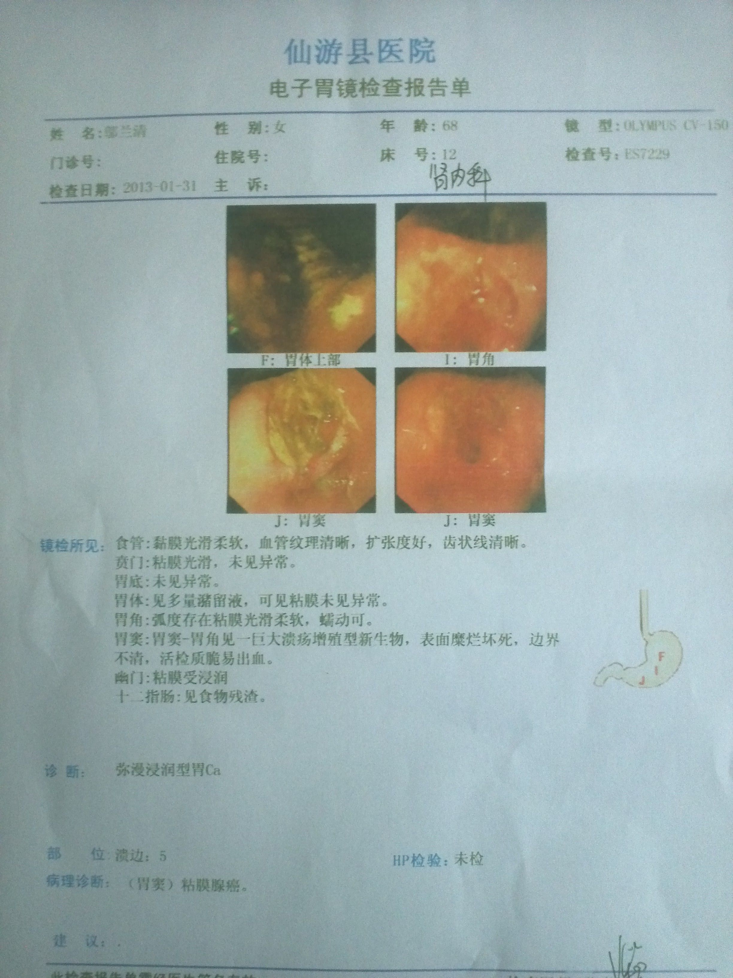 最新检查胃技术，探索胃部健康的先进诊断方法