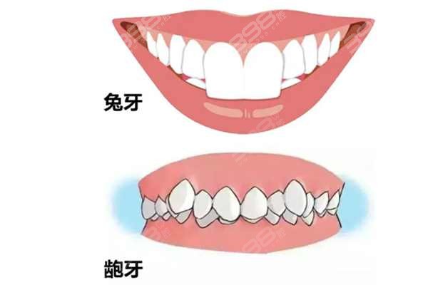 兔牙最新，时尚潮流与口腔健康的完美融合